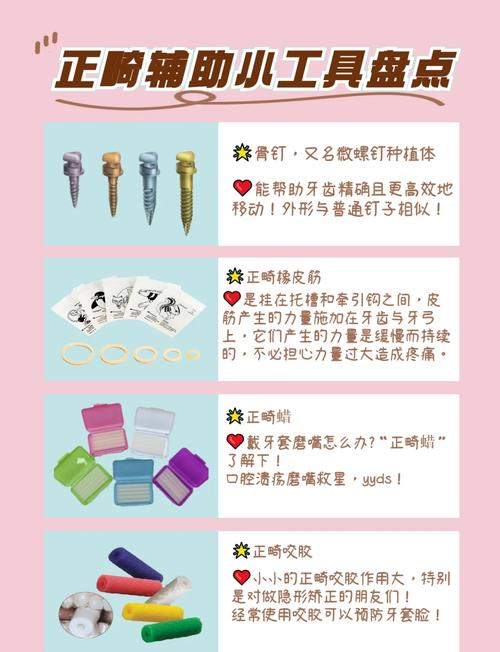 艾尔之光辅助_辅助艾希_辅助艾琳用什么辅助